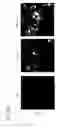 Fig. 33 - MESP1 AS A MASTER REGULATOR OF MULTIPOTENT CARDIOVASCULAR PROGENITOR SPECIFICATION AND USES THEREOF