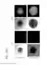 Fig. 34 - MESP1 AS A MASTER REGULATOR OF MULTIPOTENT CARDIOVASCULAR PROGENITOR SPECIFICATION AND USES THEREOF