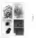 Fig. 04 - Mesenchymal precursor cell