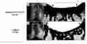 Fig. 01 - MIXED-CELL GENE THERAPY