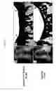 Fig. 04 - MIXED-CELL GENE THERAPY