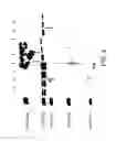Fig. 06 - COMPOSITIONS AND METHODS FOR TREATING COLLAGEN-MEDIATED DISEASES