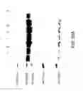 Fig. 35 - COMPOSITIONS AND METHODS FOR TREATING COLLAGEN-MEDIATED DISEASES