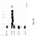 Fig. 40 - COMPOSITIONS AND METHODS FOR TREATING COLLAGEN-MEDIATED DISEASES