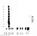 Fig. 83 - COMPOSITIONS AND METHODS FOR TREATING COLLAGEN-MEDIATED DISEASES