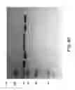 Fig. 85 - COMPOSITIONS AND METHODS FOR TREATING COLLAGEN-MEDIATED DISEASES