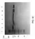 Fig. 86 - COMPOSITIONS AND METHODS FOR TREATING COLLAGEN-MEDIATED DISEASES