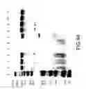 Fig. 89 - COMPOSITIONS AND METHODS FOR TREATING COLLAGEN-MEDIATED DISEASES