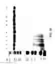 Fig. 90 - COMPOSITIONS AND METHODS FOR TREATING COLLAGEN-MEDIATED DISEASES