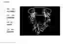 Fig. 30 - Immunoglobulin Fc polypeptides