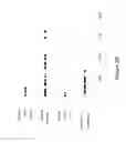 Fig. 06 - NLRR-1 antagonists and uses thereof