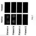 Fig. 02 - Soluble aggregate, immune tolerance inducer and manufacturing method thereof