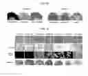 Fig. 08 - Tendon stem cells