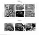 Fig. 09 - Tendon stem cells