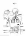 Fig. 02 - SOLID DISPERSING VACCINE COMPOSITION FOR ORAL DELIVERY