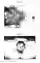 Fig. 06 - Therapeutic methods and pharmaceutical compositions for treating warts with tellurium compounds