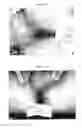 Fig. 07 - Therapeutic methods and pharmaceutical compositions for treating warts with tellurium compounds