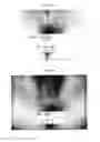 Fig. 08 - Therapeutic methods and pharmaceutical compositions for treating warts with tellurium compounds