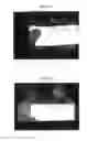 Fig. 11 - Therapeutic methods and pharmaceutical compositions for treating warts with tellurium compounds