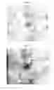 Fig. 12 - Therapeutic methods and pharmaceutical compositions for treating warts with tellurium compounds