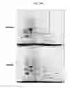 Fig. 03 - DIAGNOSTIC KIT FOR SOLID CANCER AND MEDICAMENT FOR SOLID CANCER THERAPY