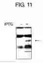 Fig. 13 - DIAGNOSTIC KIT FOR SOLID CANCER AND MEDICAMENT FOR SOLID CANCER THERAPY