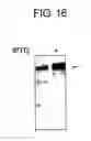 Fig. 18 - DIAGNOSTIC KIT FOR SOLID CANCER AND MEDICAMENT FOR SOLID CANCER THERAPY
