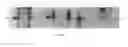 Fig. 07 - Immunogenic polypeptide isolated from subspecies and uses thereof