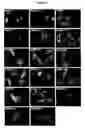 Fig. 07 - Compositions and methods for identification of PARP function, inhibitors, and activators