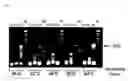 Fig. 06 - Enzyme associated with equol synthesis
