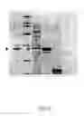 Fig. 20 - Spray dried microbes and methods of preparation and use