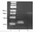 Fig. 01 - PROCESS FOR THE BIOLOGICAL PRODUCTION OF N-BUTANOL WITH HIGH YIELD