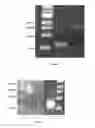 Fig. 02 - PROCESS FOR THE BIOLOGICAL PRODUCTION OF N-BUTANOL WITH HIGH YIELD
