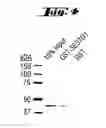Fig. 05 - COMPLEXES OF TRPC DOMAINS AND SESTD1 DOMAINS AND METHODS AND USES INVOLVING THE SAME