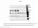 Fig. 02 - Prolyl hydroxylase inhibitors and methods of use