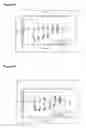 Fig. 49 - Methods and compositions for the treatment of eye disorders with increased intraocular pressure
