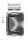 Fig. 05 - TREATMENT APPARATUS