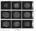 Fig. 06 - Method and apparatus for motility contrast imaging