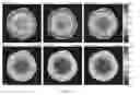Fig. 08 - Method and apparatus for motility contrast imaging