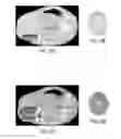 Fig. 06 - MARKER DELIVERY SYSTEM