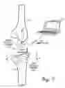 Fig. 06 - HIGH PRECISION PROCESSING OF MEASUREMENT DATA FOR THE MUSCULAR-SKELETAL SYSTEM