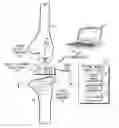 Fig. 01 - Sensing module for orthopedic load sensing insert device