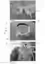 Fig. 07 - Method and apparatus for determining the absolute value of intracranial pressure