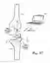Fig. 10 - TRANSDUCER DRIVER FOR MEASURING A PARAMETER OF THE MUSCULARSKELETAL SYSTEM