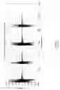 Fig. 04 - Post-beamforming compression in ultrasound systems