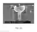 Fig. 09 - NOZZLE FOR HIGH-SPEED JETTING DEVICES