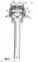 Fig. 08 - Valve assembly including diameter reduction structure for trocar
