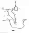 Fig. 05 - Self contained wound dressing apparatus
