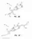 Fig. 08 - Treatment of movement disorders by brain stimulation