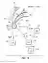 Fig. 10 - Treatment of movement disorders by brain stimulation